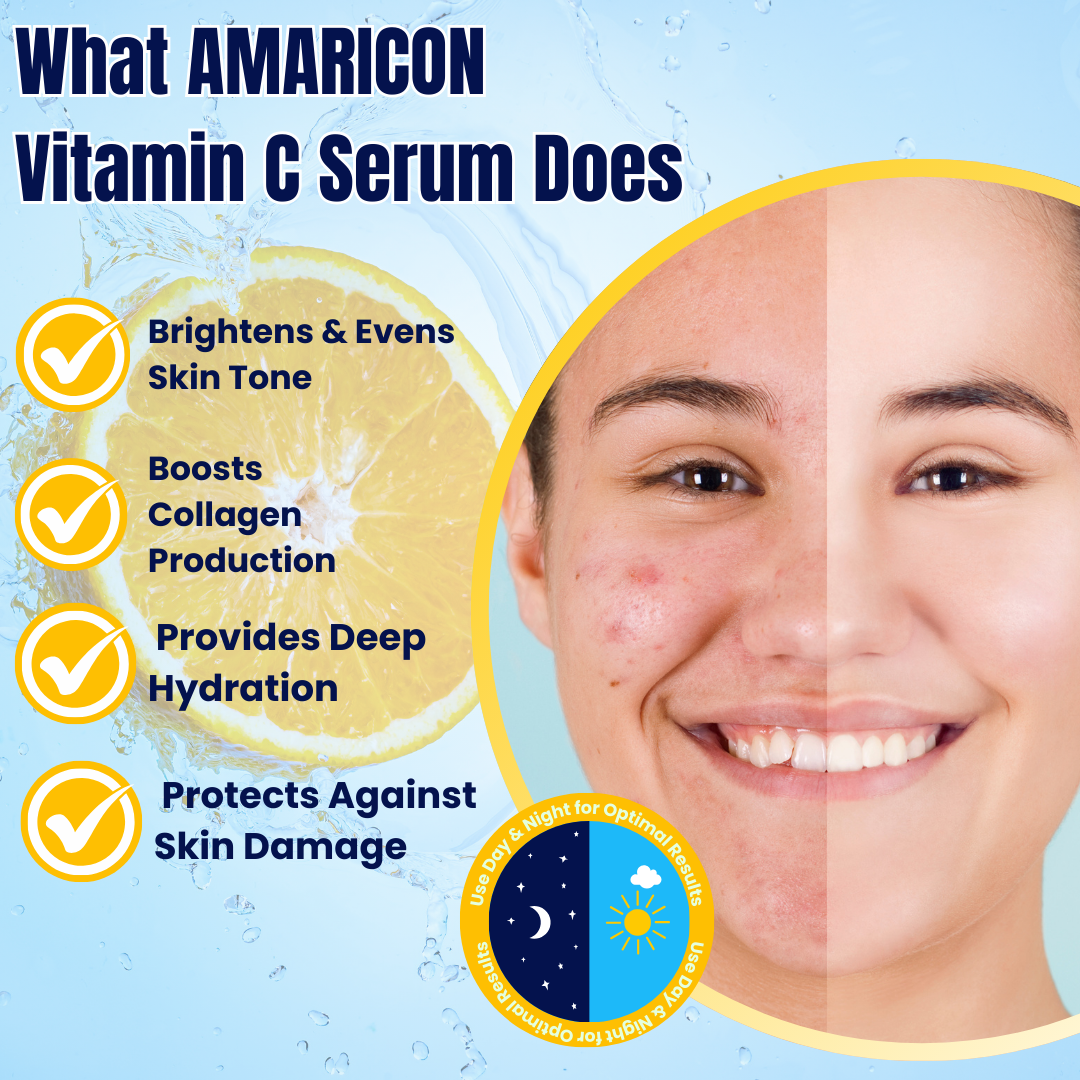 Vitamin C Serum – Brightening & Hydrating – Collagen-Boosting – 1 fl oz
